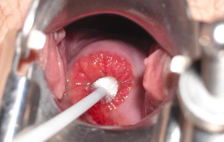 cervix