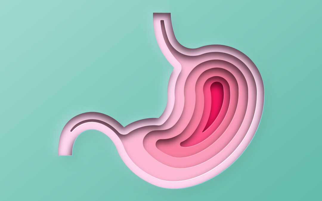 The symptoms of colon cancer that every young woman should know about